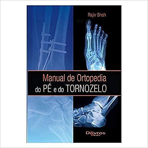 MANUAL DE ORTOPEDIA DO PÉ E DO TORNOZELO_